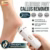 Electric Callus Remover Deal | Easy Home Foot Care & Exfoliation Tool